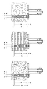 Keuco KE Bef.-Set 1 Plan Care 34990, 3xHolzschr.DIN7996-6x70 V2A 3xDübel UX8R, 34990000100